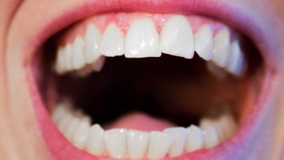 Признаки рака полости рта, о которых должен знать каждый