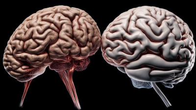 Ученые продолжают исследовать отличия женского мозга от мужского