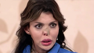 Бывшая жена Аршавина вернула нос при помощи пластической операции