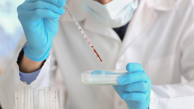 Ученые научились определять биологический возраст по анализу крови