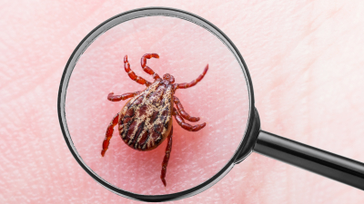Роспотребнадзор: Как защитить себя от клещевого вирусного энцефалита