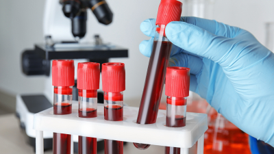 Анализы крови будут брать по-новому: ученые разработали уникальное устройство