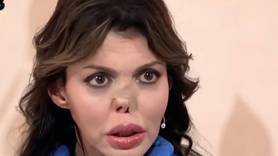 Экс-супругу Аршавина осуждают за дополнительные операции на лице